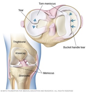 A diagram of a knee
